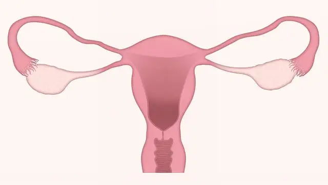 자궁경부암 초기증상